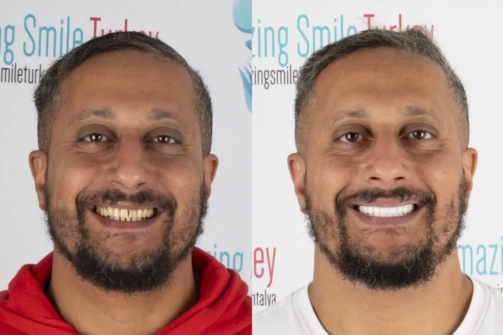 Before after6 copy