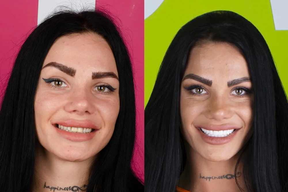 Before after2 copy
