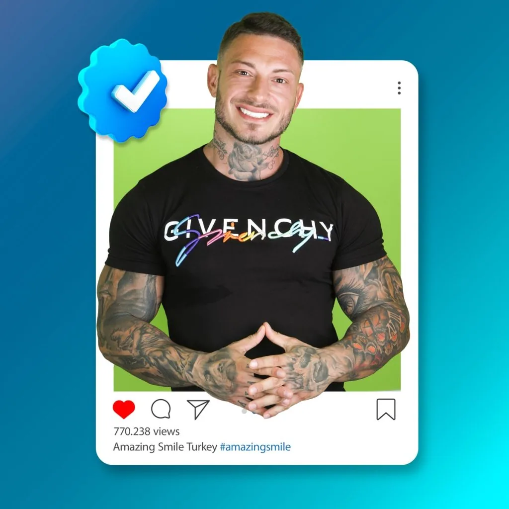 Ast insta template 2