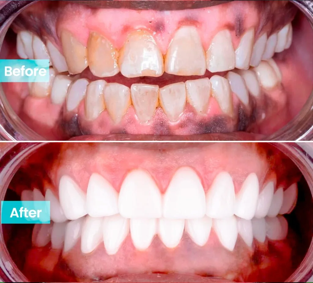 Ast mainpage zirconium final temmuz