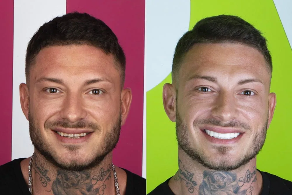 Before after5 copy