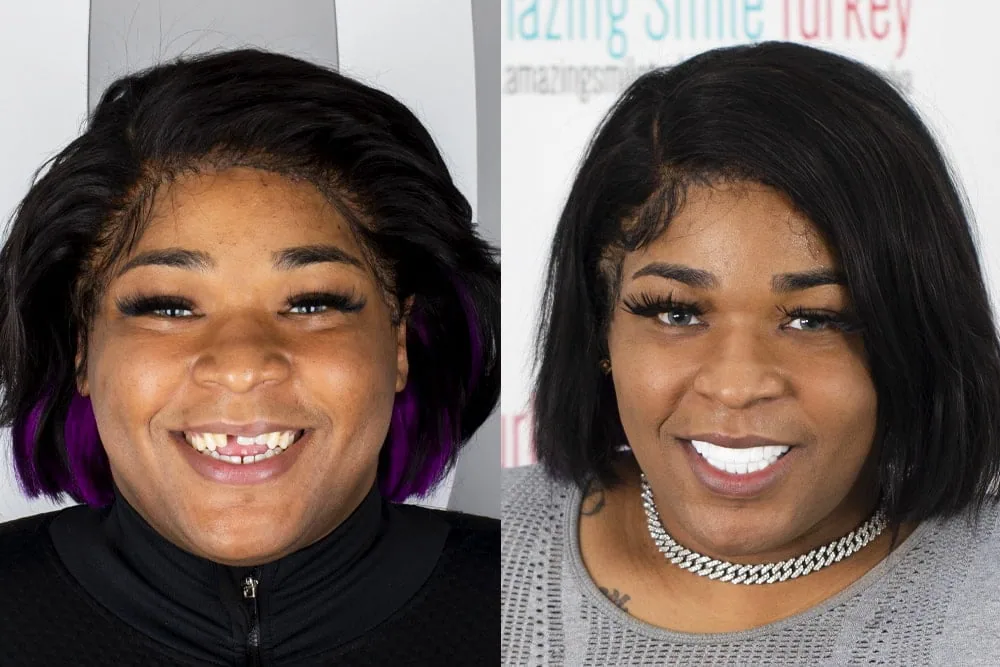 Before after4 copy