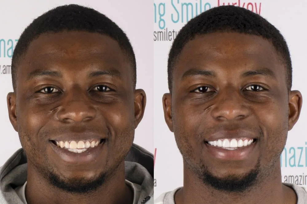 Before after3 copy