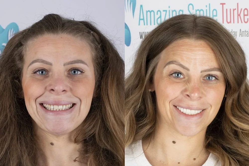 Before after7 copy