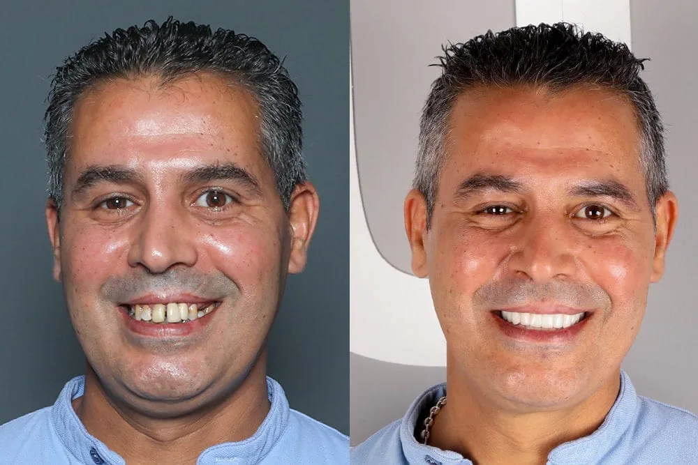 Before after1 copy
