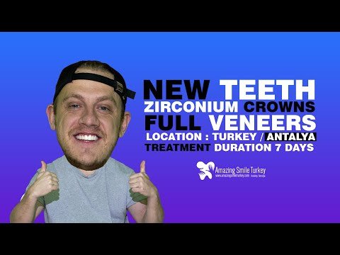 ZIRCONIUM CROWNS FULL VENEERS  #zirconiumveneers #veneers