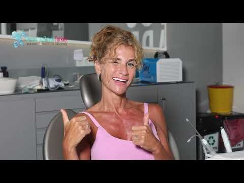 TRAITEMENT DENTAIRE TURQUIE / DENTAL TREATMENT TURKEY