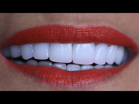 TRAITEMENT DENTAIRE TURQUIE / DENTAL TREATMENT TURKEY