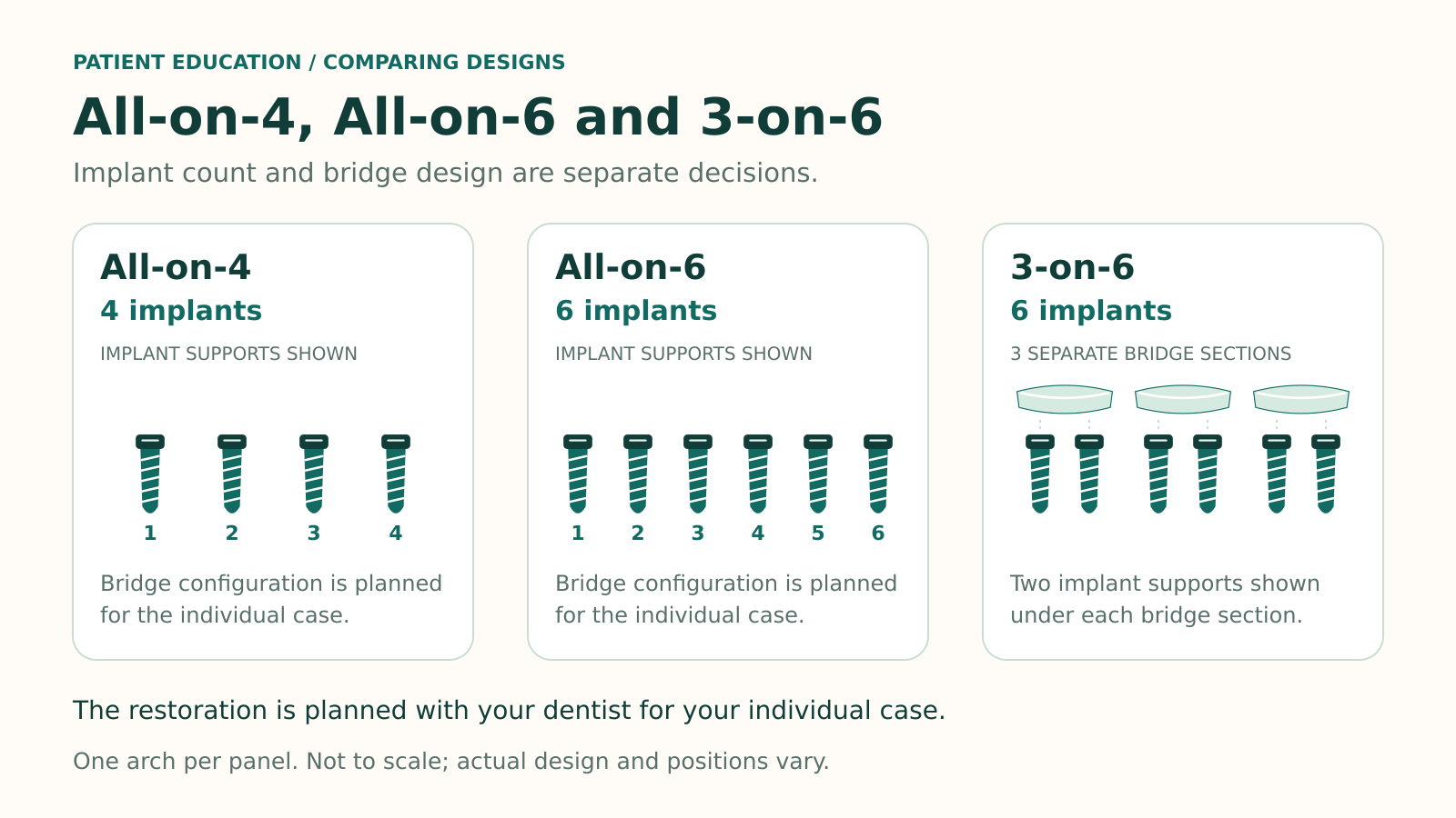 3-on-6 vs All-on-4 vs All-on-6: Understanding the Differences